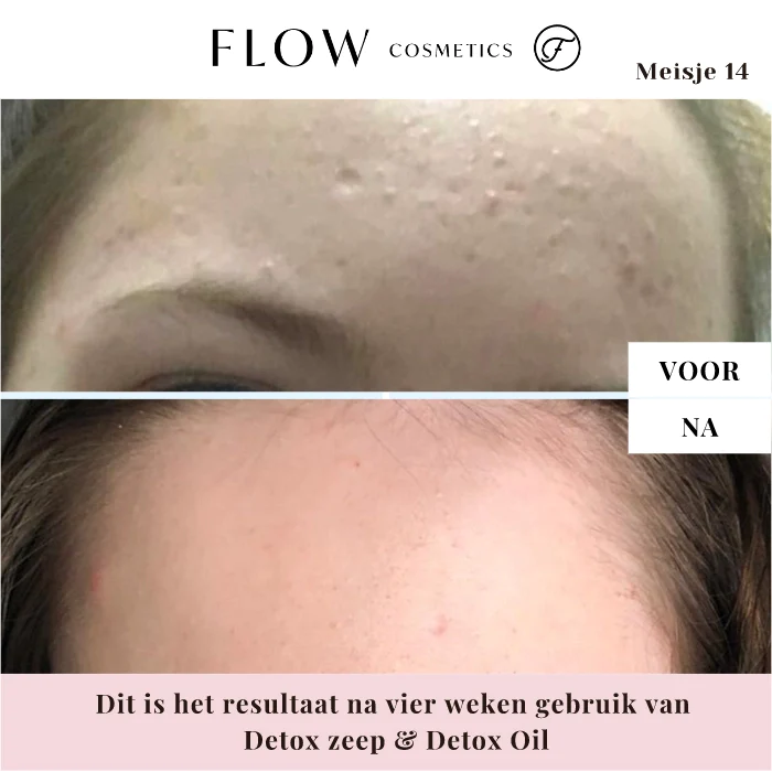 Deze zeep maakt je huid niet droog omdat het biologische sheaboter, biologische jojoba olie en biologische sesamolie bevat die je huid gehydrateerd en beschermd houden.